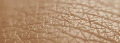 Consultation d'un dermatologue : prix et remboursement peau dermatologue