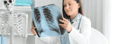 Remboursement d'un pneumologue et rôle de la mutuelle pneumologue radio